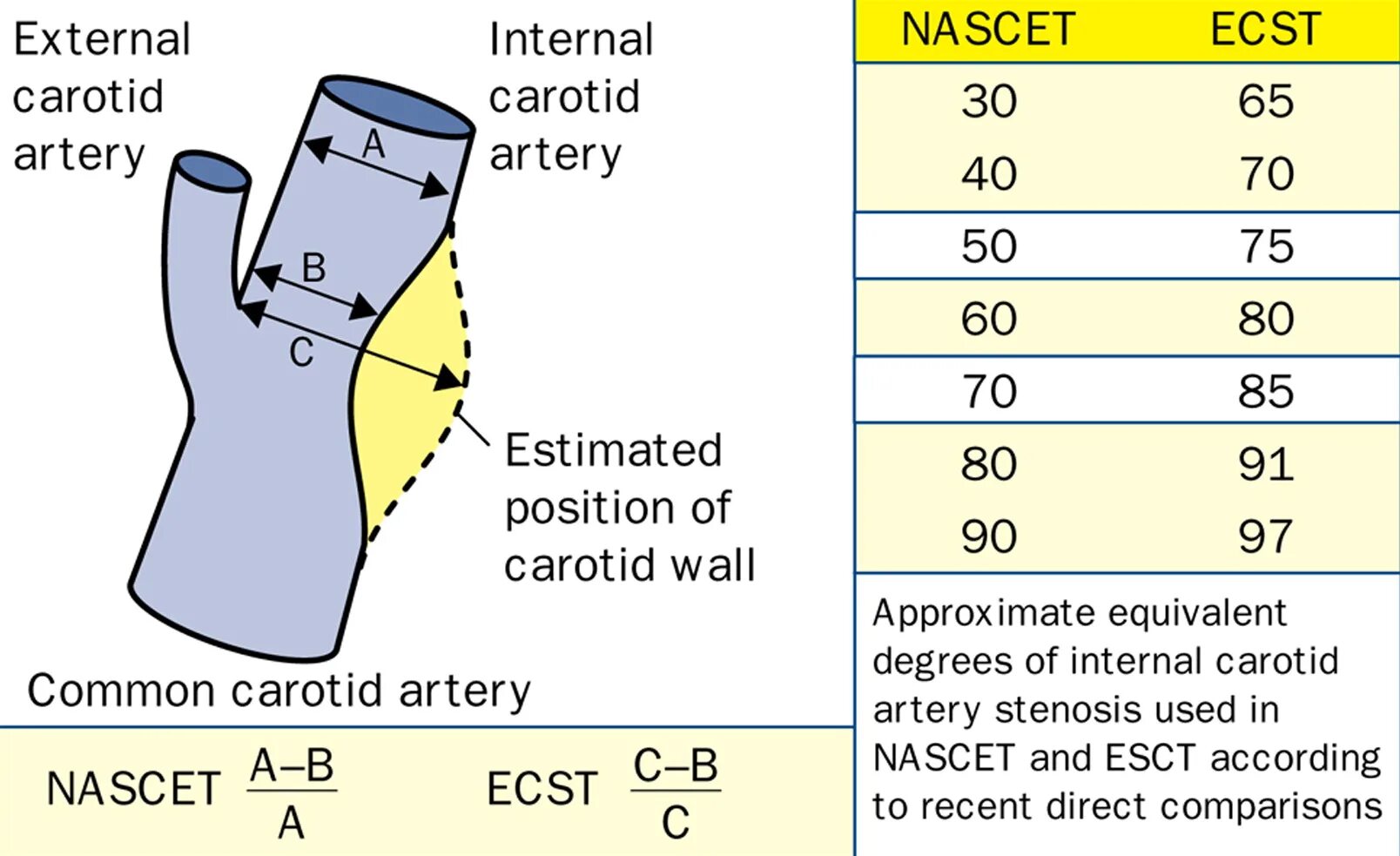 Измерение степени стеноза по nascet. Оценка степени стеноза сонных артерий. Стеноз ВСА по nascet. Измерение стеноза ВСА. Penis calculator