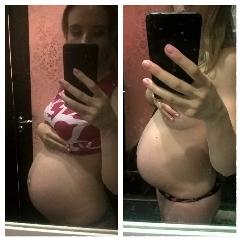 Опущение живота перед родами. Опущенный живот при беременности до и после. Почему опускается живот