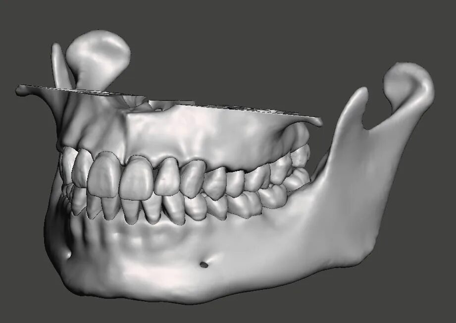 03д модель челюсти. Моделирование челюсти. 3д зубы моделирование.