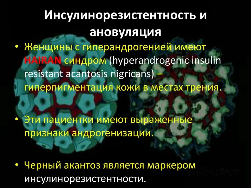 Инсулинорезистентность симптомы у мужчин. Инсулинорезистентность. Инсулинорезистентность симптомы. Симптомы инсулинорезист. Признаки инсулинорезистентности.