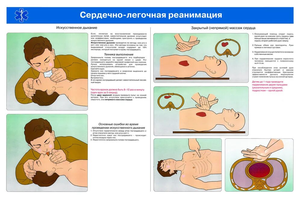 Оказание первой помощи пострадавшим искусственное дыхание. СЛР непрямой массаж сердца. Сердечно-легочная реанимация (СЛР) таблица. ИВЛ И непрямой массаж сердца алгоритм. Сердечно-легочная реанимация плакат.