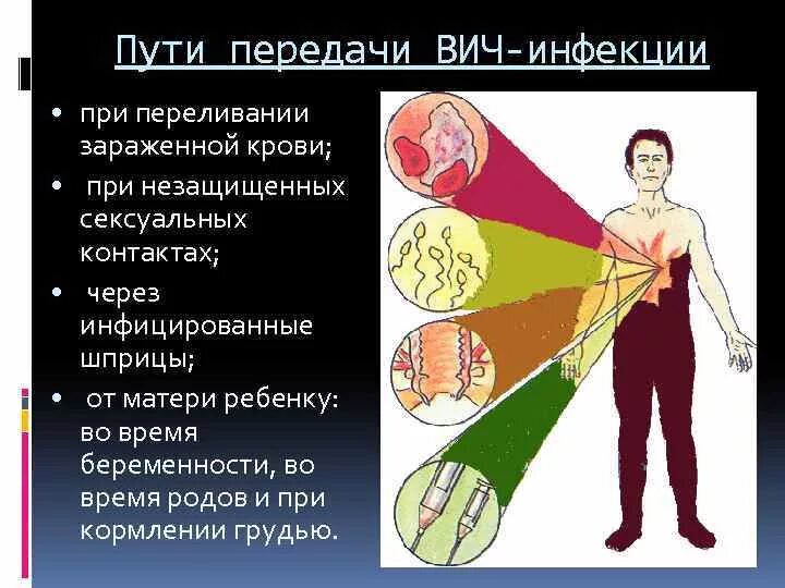 Вич пути заражения и профилактика. Основные способы передачи ВИЧ. Пути заражения ВИЧ- инфекцией схема. Способы заражения СПИДОМ. Пути передачи ВИЧ И СПИД инфекций.