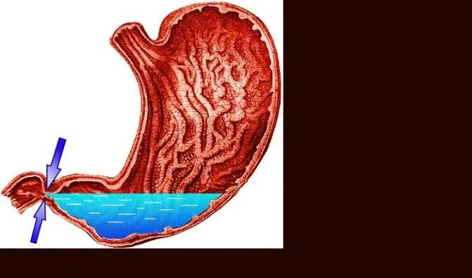 Сфинктер между желудком и пищеводом. Препараты для моторики желудка. Гастральный рефлюкс желчи. Чоо нельзя ест на голодныйжелудок. Дуодено гастрит рефлюкс.