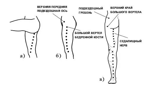 Можно делать массаж при защемлении нерва. Седалищный нерв точки акупунктуры. Точечный массаж седалищного нерва. Точечный массаж (Акупрессура) при ишиасе. Седалищный нерв точки воздействия.