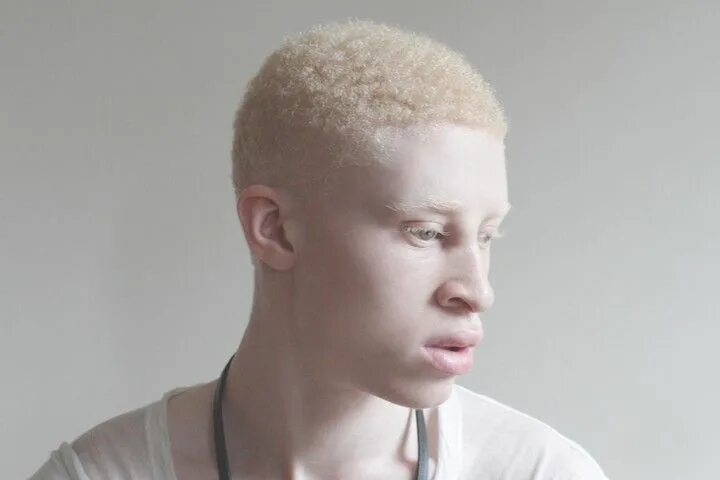 Человек с самой светлой. Шон Росс альбинос. Альбинос негроидной расы. Альбиносы люди негроиды. Шон Росс фото.