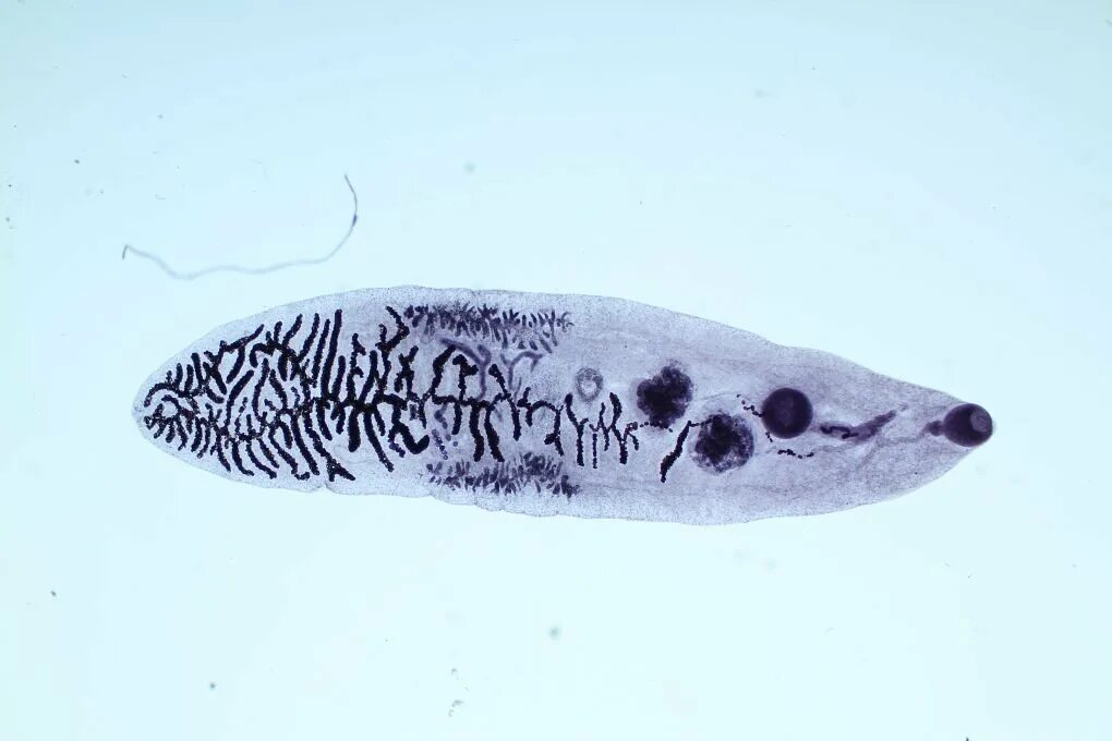 Ланцетовидный сосальщик. Ланцетовидный сосальщик (Dicrocoelium lanceatum). Ланцетовидный сосальщик строение. Фасциолез животных