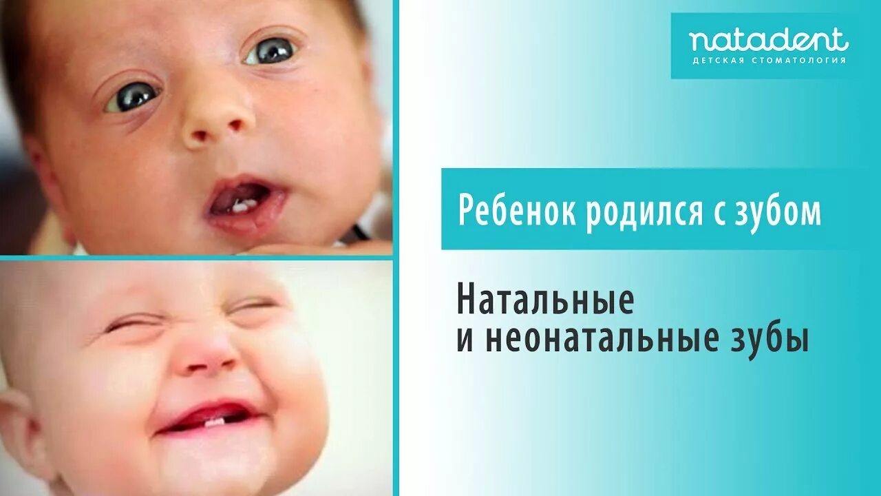 Рождаются ли говорящие дети. Рождение ребенка с зубами. Натальные и неонатальные зубы. Младенец родился с зубами.