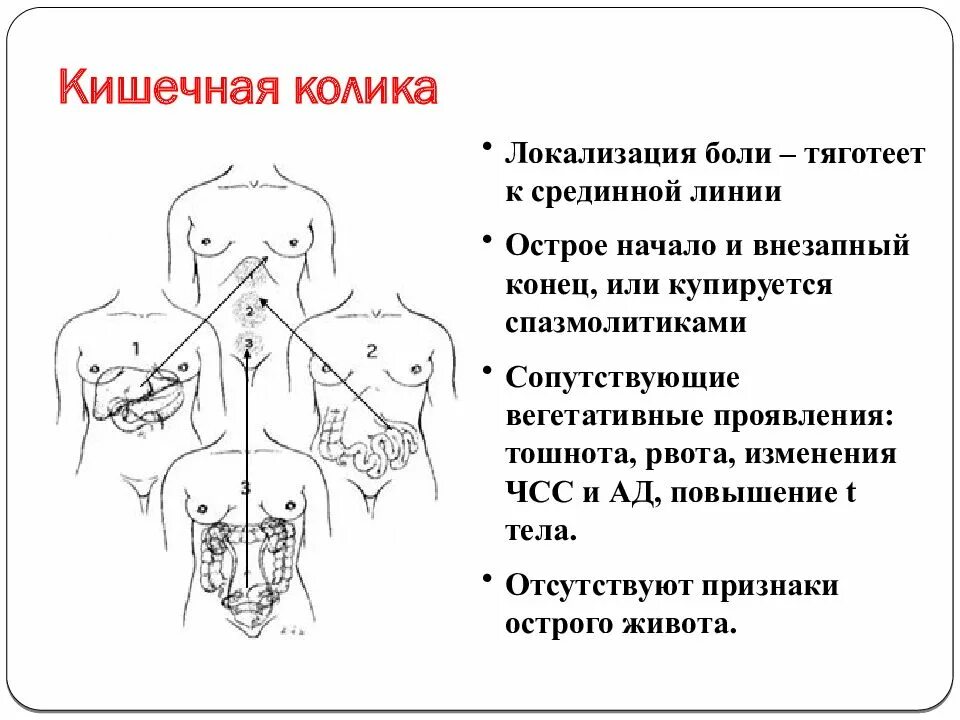 Код по мкб кишечная колика у детей. Кишечная колика локализация боли. Локализация боли при кишечной колике. Синдром кишечной колики пропедевтика. При кишечных коликах.