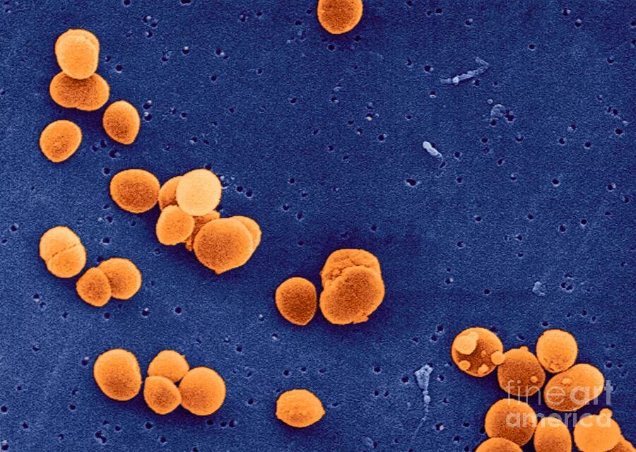 Staphylococcus aureus 5. Золотушный стафилококк. Золотистый стафилококк 3. Золотистый стафилококк с10. S. aureus золотистый стафилококк.