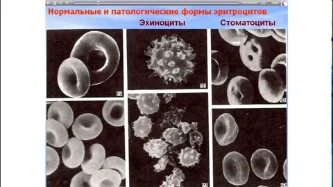 Эритроциты лейкоциты слизь в моче