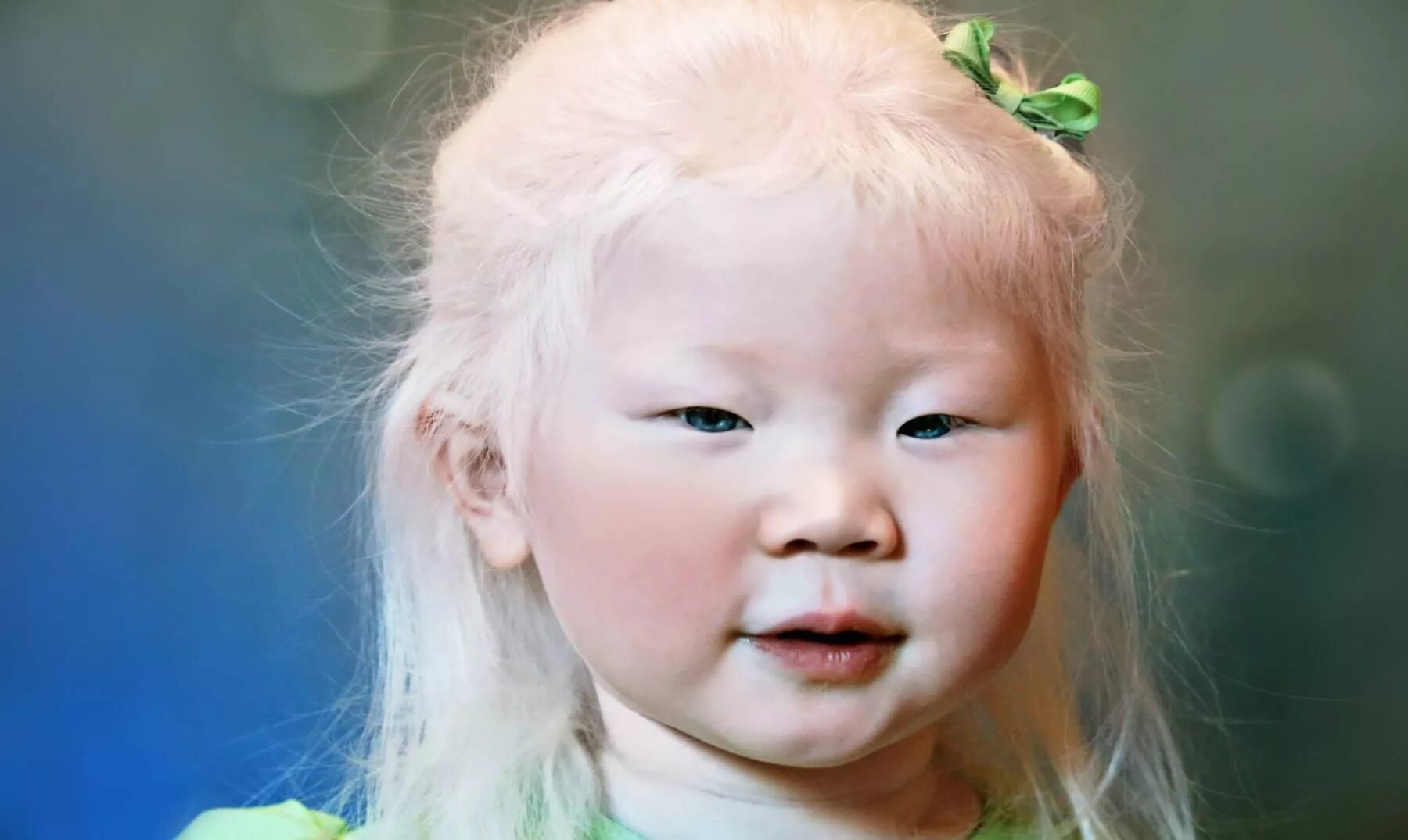 Узкоглазые россии. Альбинос китаянка Конни Чиу. Альбиносы монголоидной расы. Монгол альбинос. Глазокожный альбинизм.