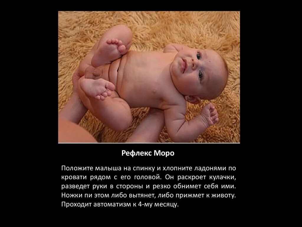 Рефлекс моро у грудничка. Рефлекс моро у новорожденных. Шаговый рефлекс у новорожденного. Ломаная и вершины 1 класс моро. Моро когда проходит.