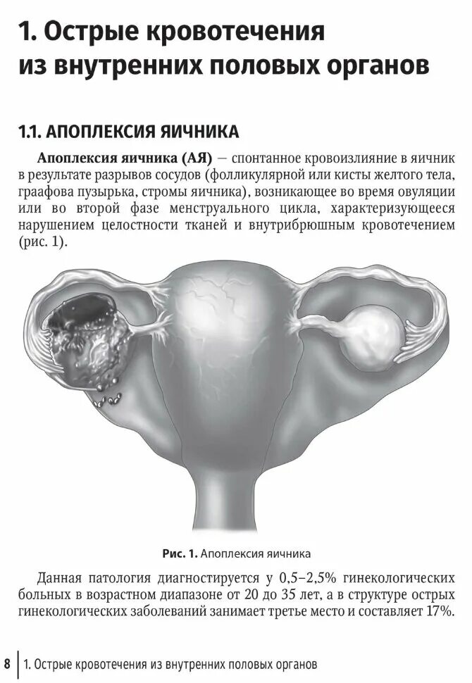 Острый живот в гинекологии рекомендации