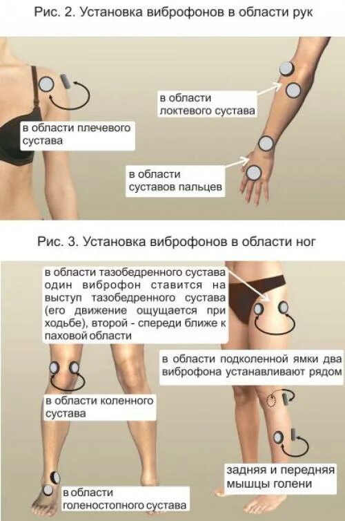 Инструкция по применению по картинке. Аппарат Витафон точки воздействия. Витафон при артрозе коленного сустава схема. Аппарат фонирования для суставов Витафон. Инструкция аппарата Витафон ИК.