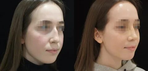 Андриянова Ирина Владимировна - пластический хирург клиники Effi