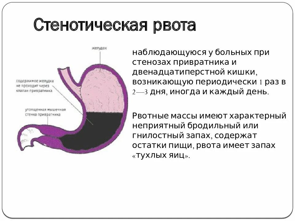 Рвота с запахом тухлых яиц. Стеноз привратника причины.