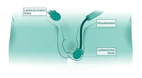 Интимный ликбез- беременность через анус это миф или реальность?