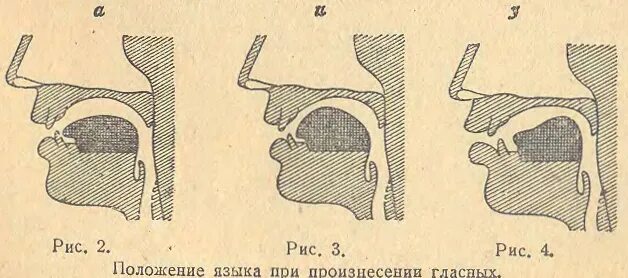 Правильное положение языка. Положение языка в ротовой полости. Правильное и неправильное положение языка. Язык во рту в спокойном состоянии