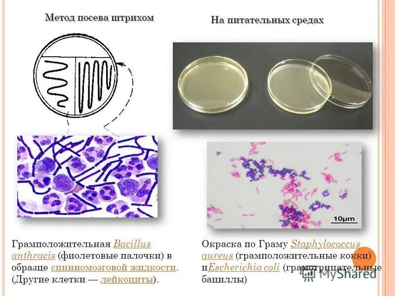 схема посева на питательные среды. методы посева микроорганизмов на питательные среды. методы посева бактерий на питательную среду. метод посева на питательные среды. техники посева микроорганизмов на питательные среды.