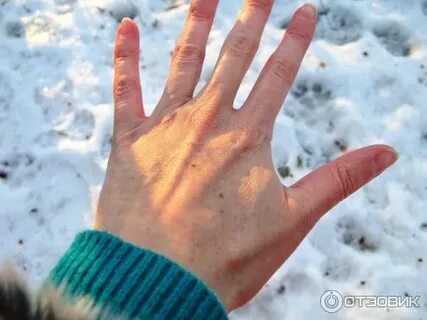 Похолодание пальцев