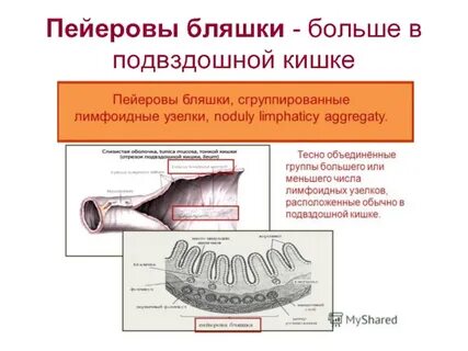 Пейеров бляшки