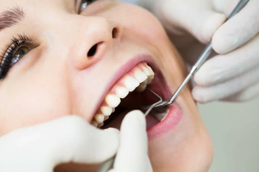 Три стоматолога. Профгигиена полости рта. Ультразвуковая чистка зубов. Профессиональная гигиена.