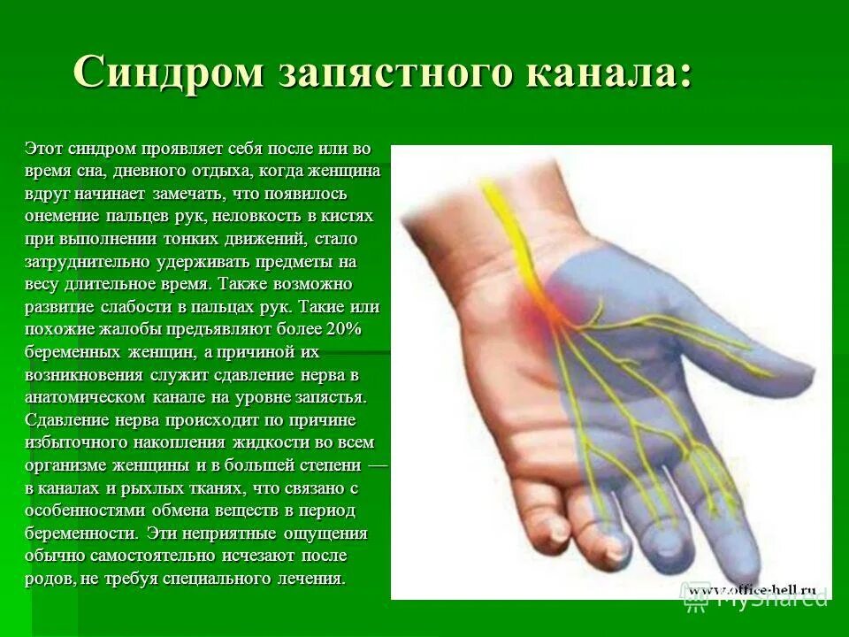 Почему часто немеют. Синдром запястного канала. Кистевой туннельный синдром. Туннельный синдром запястья. Костевой ьуннельный синжрлм.