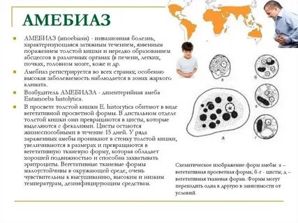 Характерные симптомы амебиаза