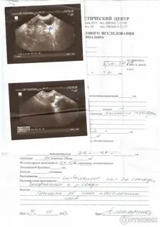 Трансвагинальное узи на каком сроке