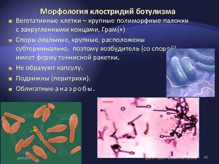 Клостридиум ботулинум морфология. Клостридия морфология. Клостридиум перфрингенс морфология. Clostridium botulinum морфология.