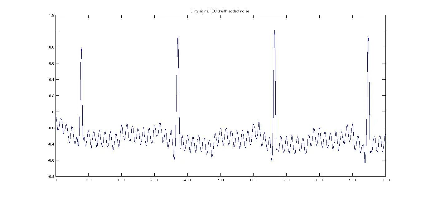 Сигналы в матлабе. Сигналы в матлабе. Акф лчм сигнала матлаб. Сигнал электрокардиограммы. Генератор прямоугольных импульсов матлаб.
