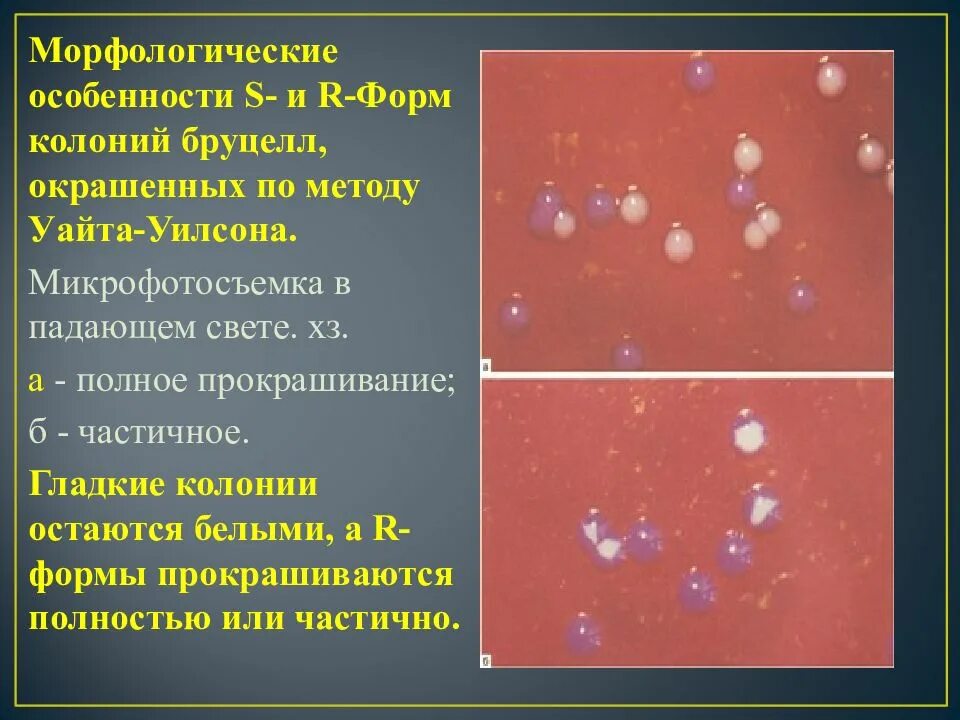 S r формы. Бруцеллы резистентность. морфологические особенности бруцелл:. колонии s и r формы. устойчивость бруцелл.