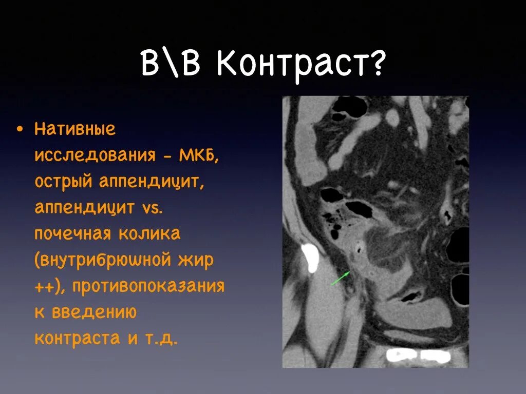 Как готовится кт брюшной полости с контрастированием. Кт брюшной полости (контрастирование. венозная фаза контрастирования при кт. кт болюсное контрастирование. кт органов брюшной полости с контрастом.