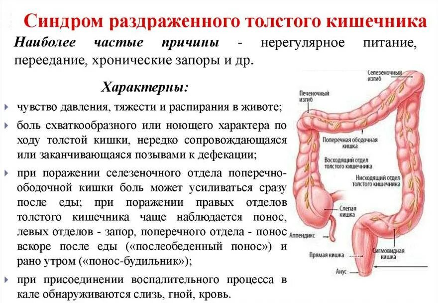 Каловая интоксикация симптомы. Синдром раздраженного кишечника толстой кишки симптомы. синдром раздраженной кишки. толстой кишечник болить.