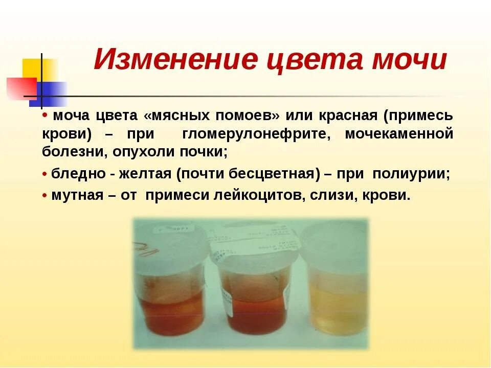 Почему писаешь кровью девушка