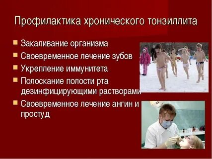 Профилактика ангины у взрослых