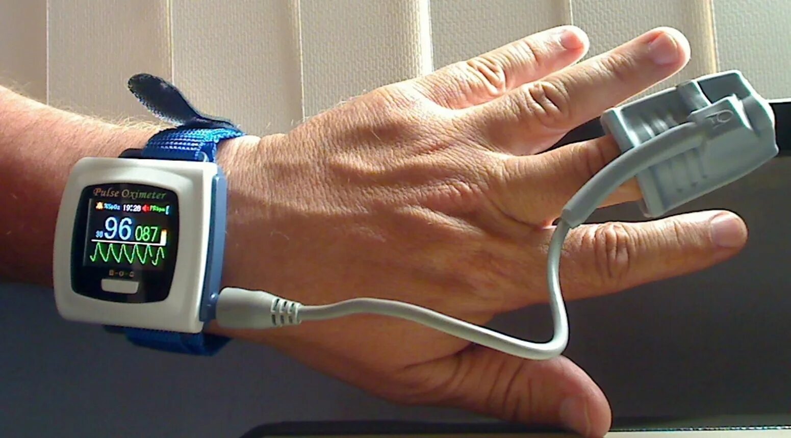 Пульс микрона. Пульсоксиметр pulse oximeter 2013 года. пульсоксиметр covid 19. пульсоксиметр с pm 50. пульсоксиметр x1906.