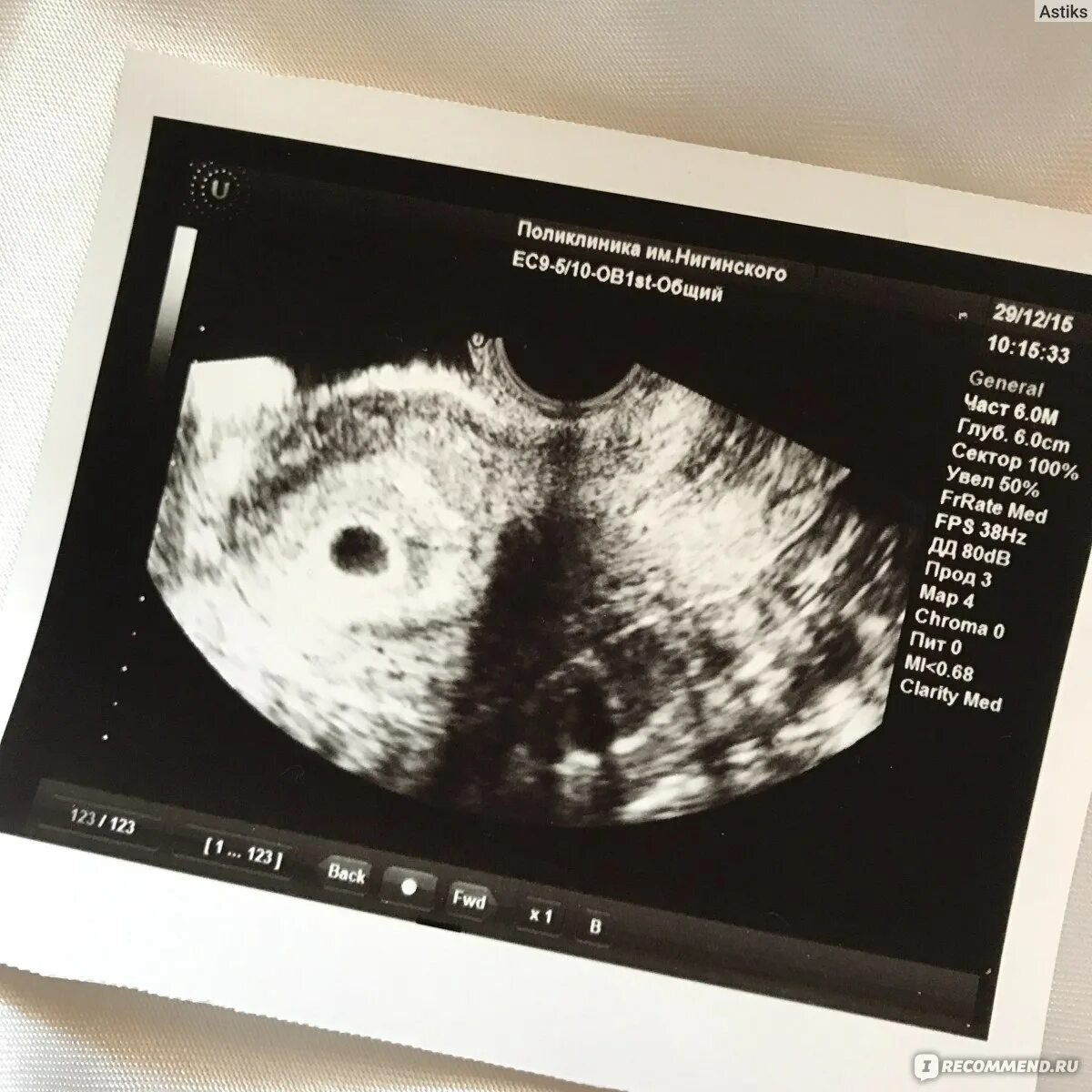УЗИ 3-4 недели беременности. УЗИ 4 недели беременности. Снимок УЗИ беременности 3-4 недели. Узи 3 4 недели