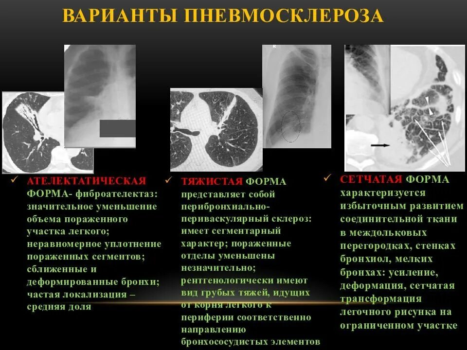 Это опасно фиброза