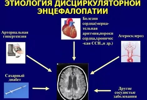 Признаки энцефалопатии что это