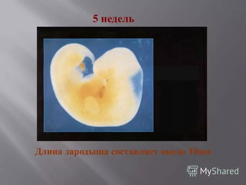 4 неделя берем. 4 неделя берем