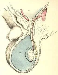Одан шыққан сперматозоидтары бар кисканың үлкен суреті