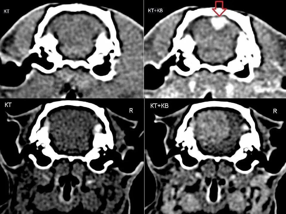 Новообразование гипофиза у крысы. Кт поп. Кровь после кт