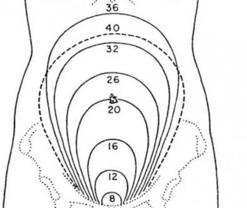 Расположение дна матки по неделям беременности. Высота дна матки на 20 неделе беременности. Высота дна матки (ВДМ). Высота дна матки в разные сроки беременности.