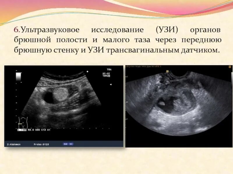 УЗИ брюшной полости беременность. Абдоминальное УЗИ. Ультразвуковое исследование брюшной полости. УЗИ малого таза при беременности на ранних. Брюшная полость что входит на узи