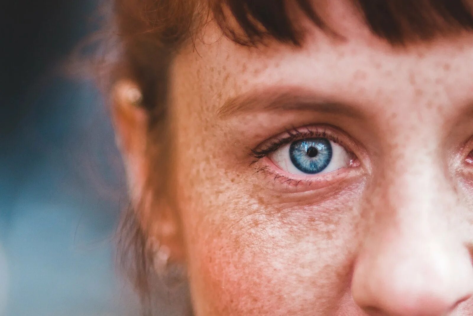 У несчастных женщин пустые глаза. Even Freckles Skin closeup.