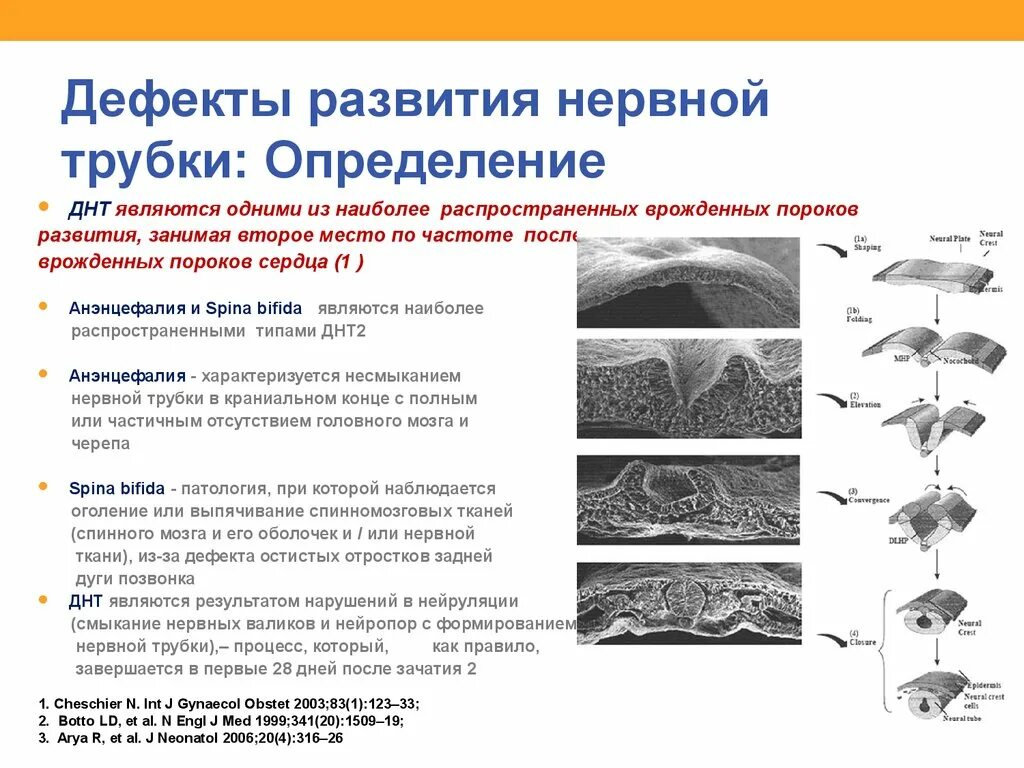 Аномалии развития нерва. Формирование нервной трубки эмбриона. Патология развития нервной трубки. Пороки развития нервной трубки виды. Дефект нервной трубки на УЗИ.