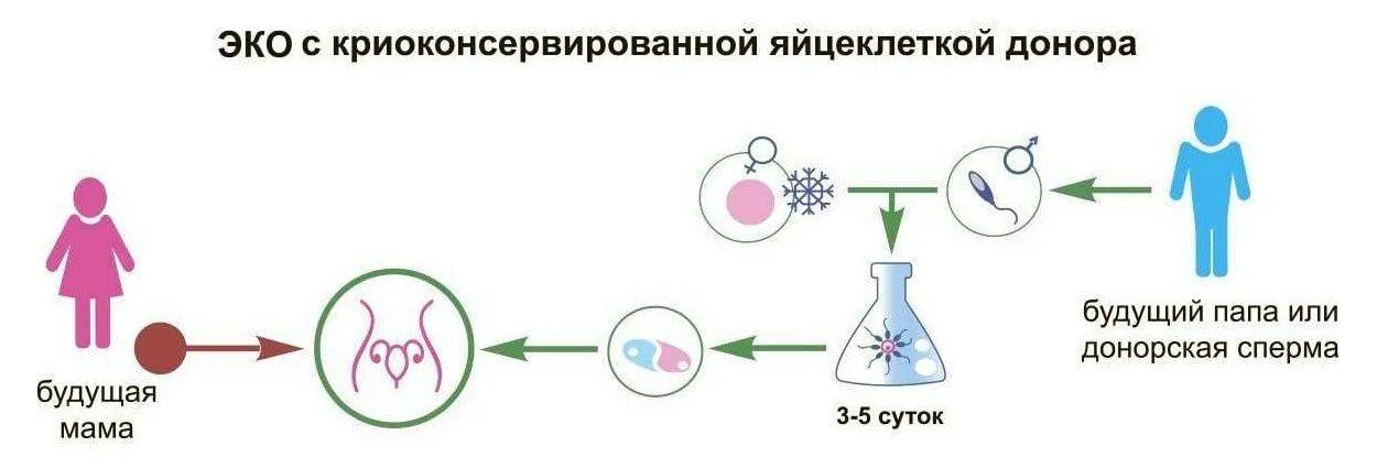 Бесплодие донор