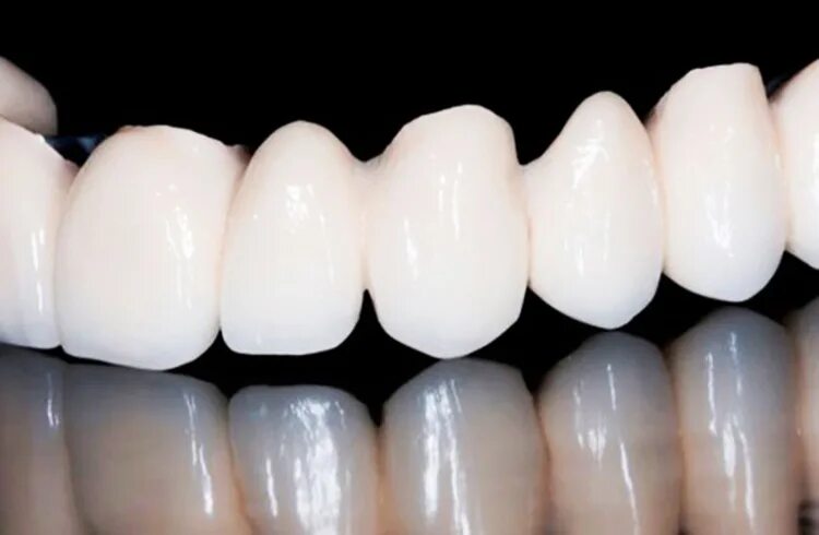 Диоксид циркония коронки. Коронка металлокерамика. Безметалловая керамика диоксид циркония. Металлокерамика заготовка. Металлокерамика заготовка.