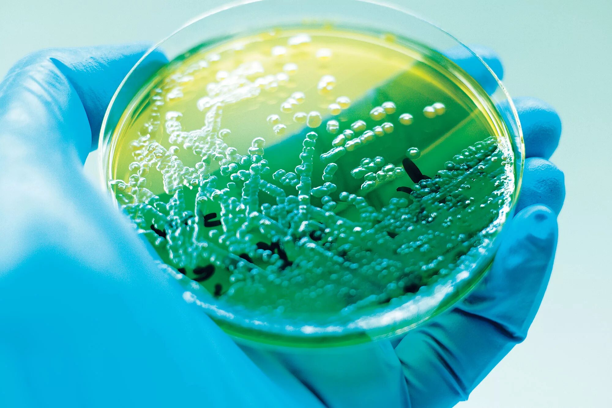 Синегнойная палочка в чашке Петри. Псевдомонада aeruginosa. Pseudomonas aeruginosa (синегнойная палочка). Pseudomonas aeruginosa микробиология. Разрушающие микроорганизмы